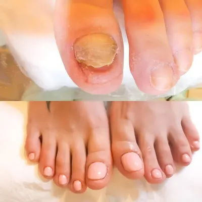 Pedica - Usługi podologiczno-kosmetyczne